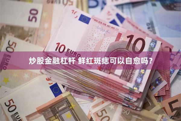 炒股金融杠杆 鲜红斑痣可以自愈吗？